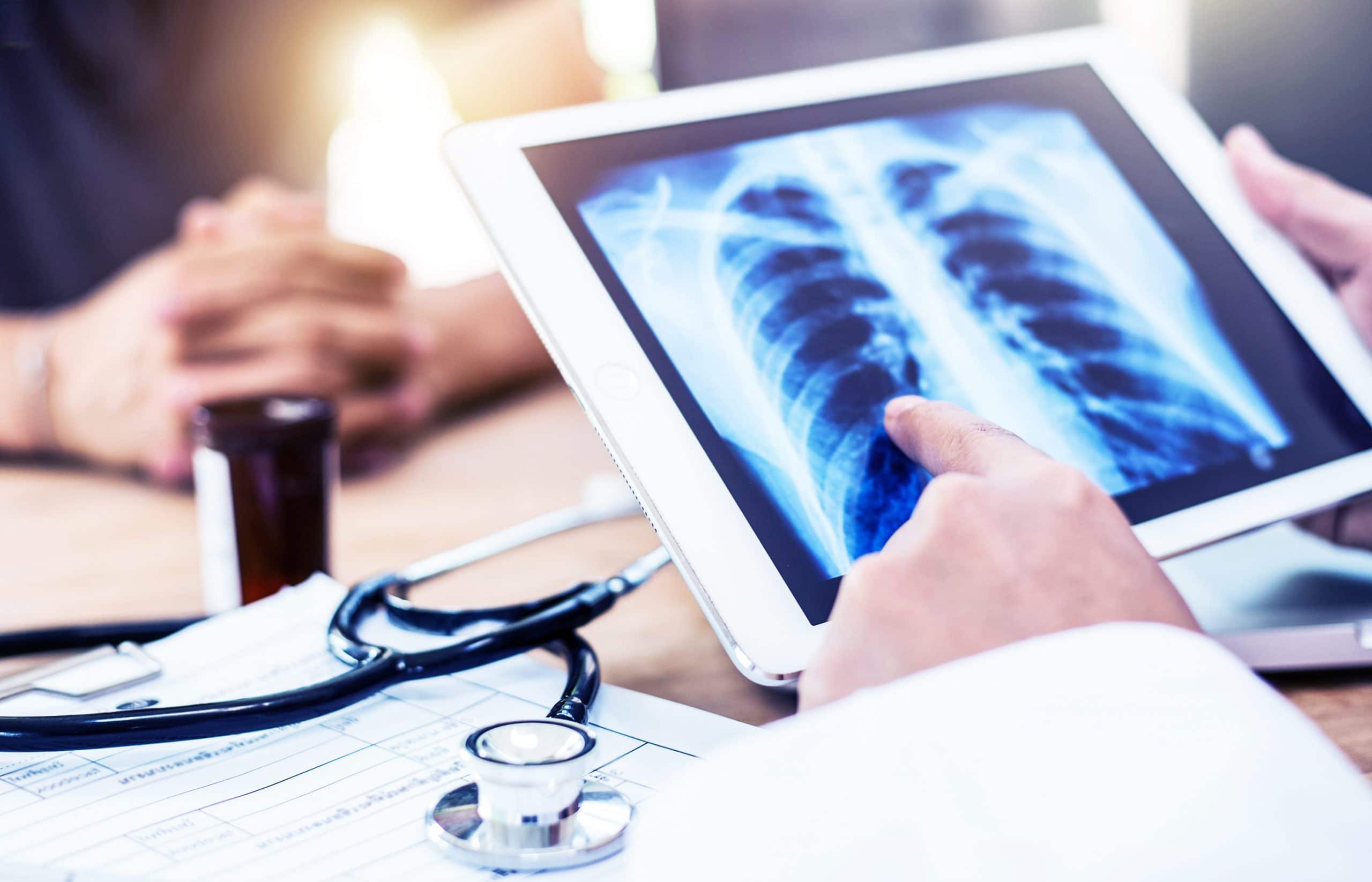 This is an image of a doctor explaining the specific type of lung cancer to the patient.