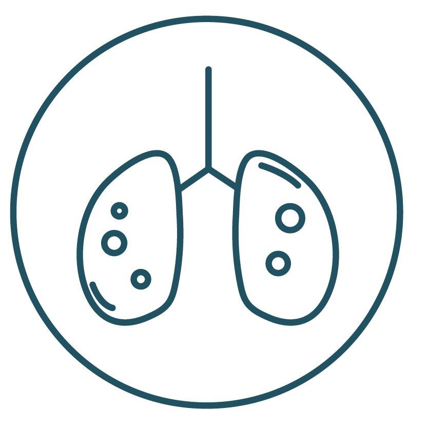 This is an icon displaying the small cell lung cancer.
