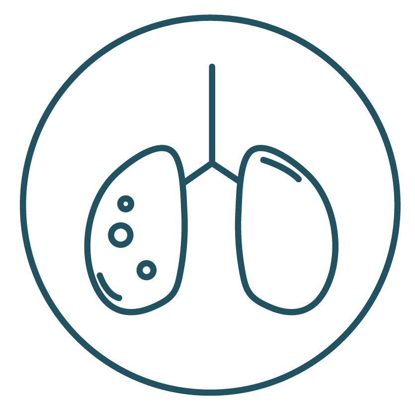 This is an icon displaying non-small cell lung cancer.