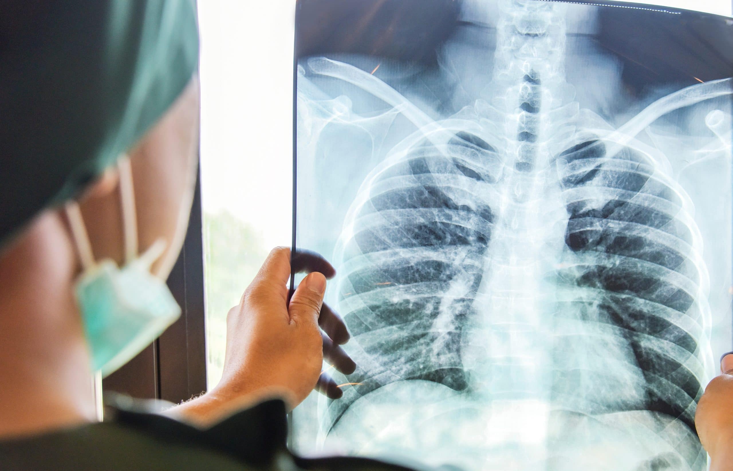 This is an image of an x-ray technician looking at an early screening results for potential lung cancer signs.