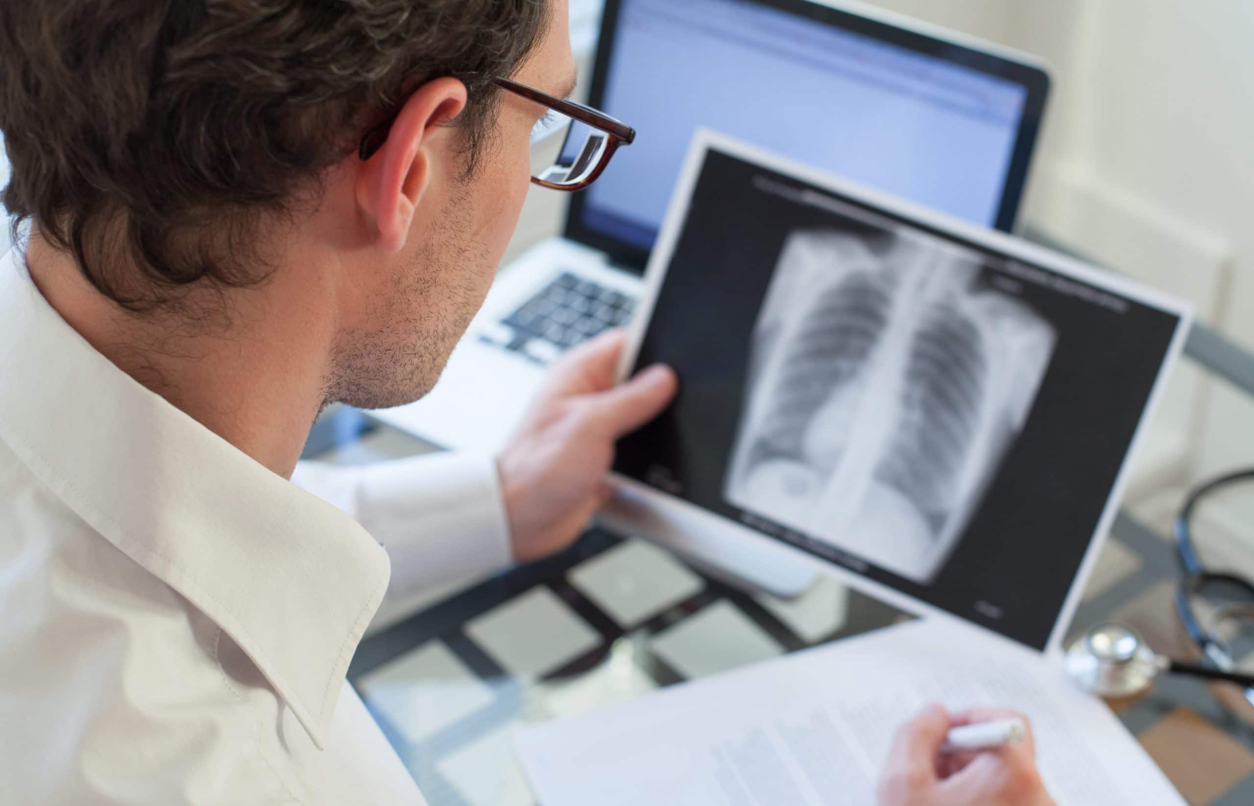 This is an image of a doctor looking over a patients Small Cell Lung Cancer results.