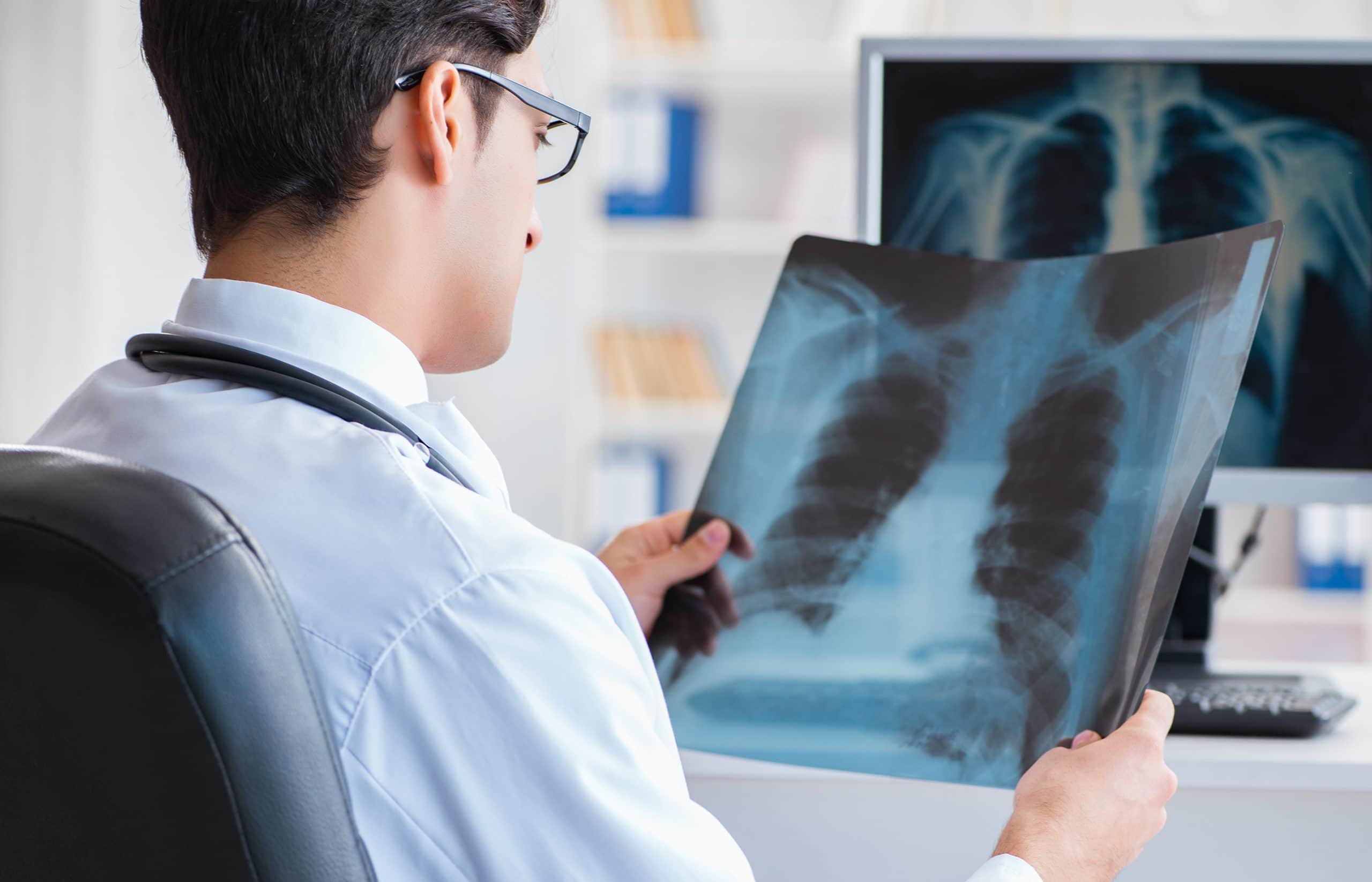 This is an image of a doctor looking at the x-rays of lungs.
