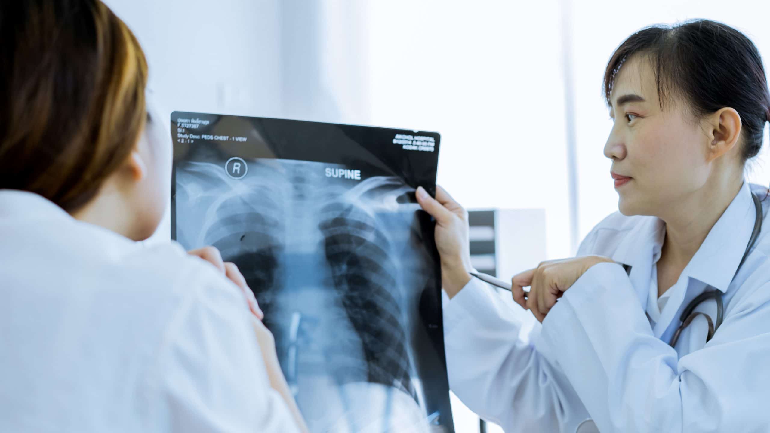 This is an image of of two medical professional discussing the different stages of lung cancer.