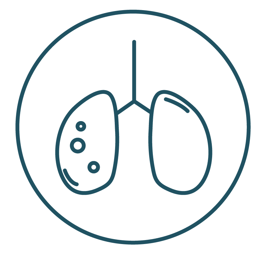 Stages of Non-Small Cell and Small Cell Lung Cancer