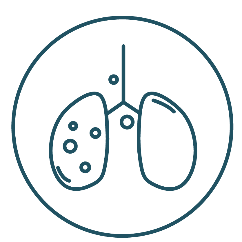 This is an icon representing stage III of lung cancer.