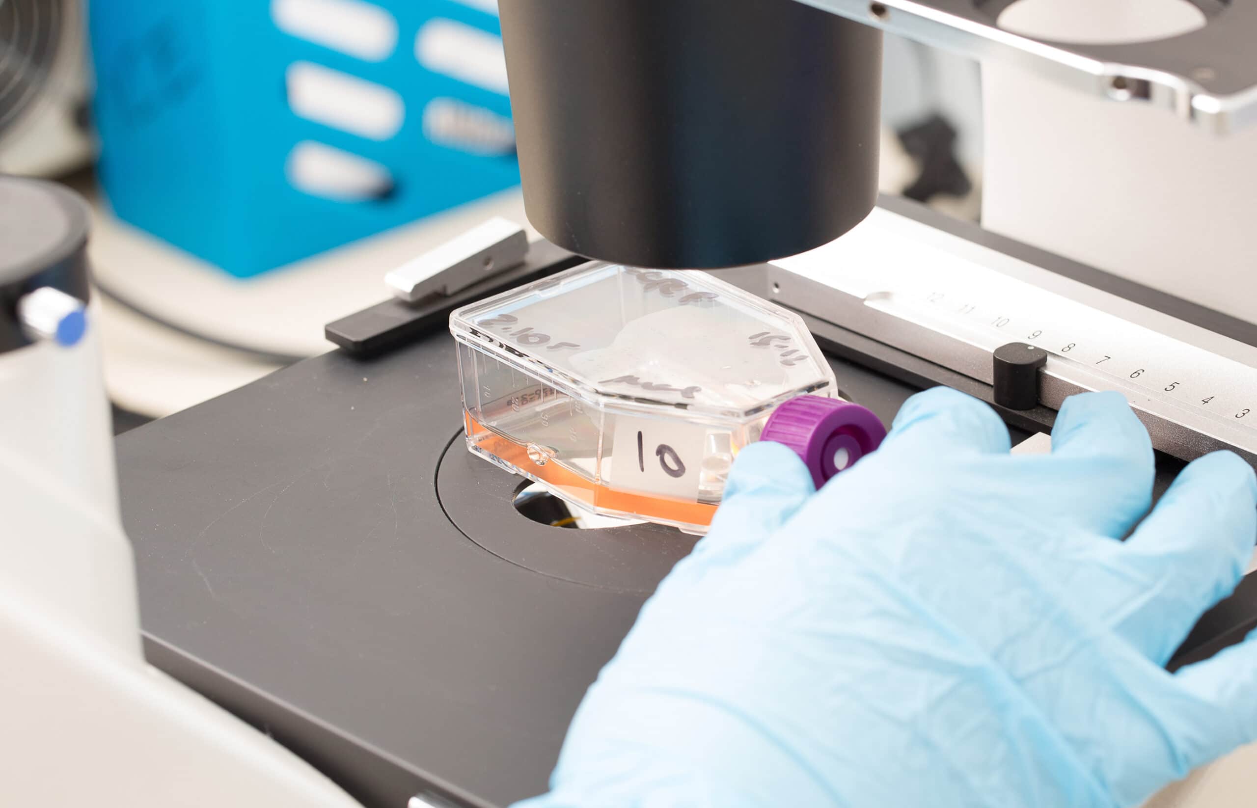 A mediclal professional studying cells under a microscope.