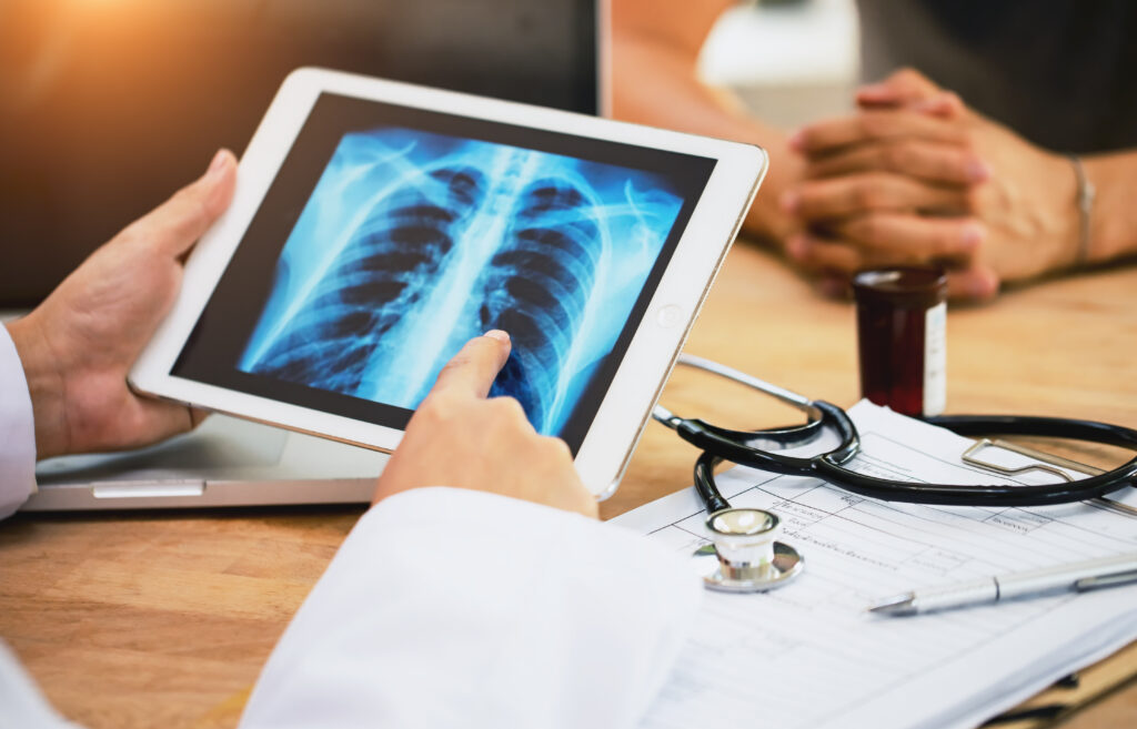 Tablet showing x-ray as doctor explains the mesothelioma stages of cancer.