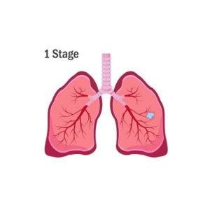 early pleural disease