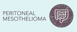 Peritoneal mesothelioma type