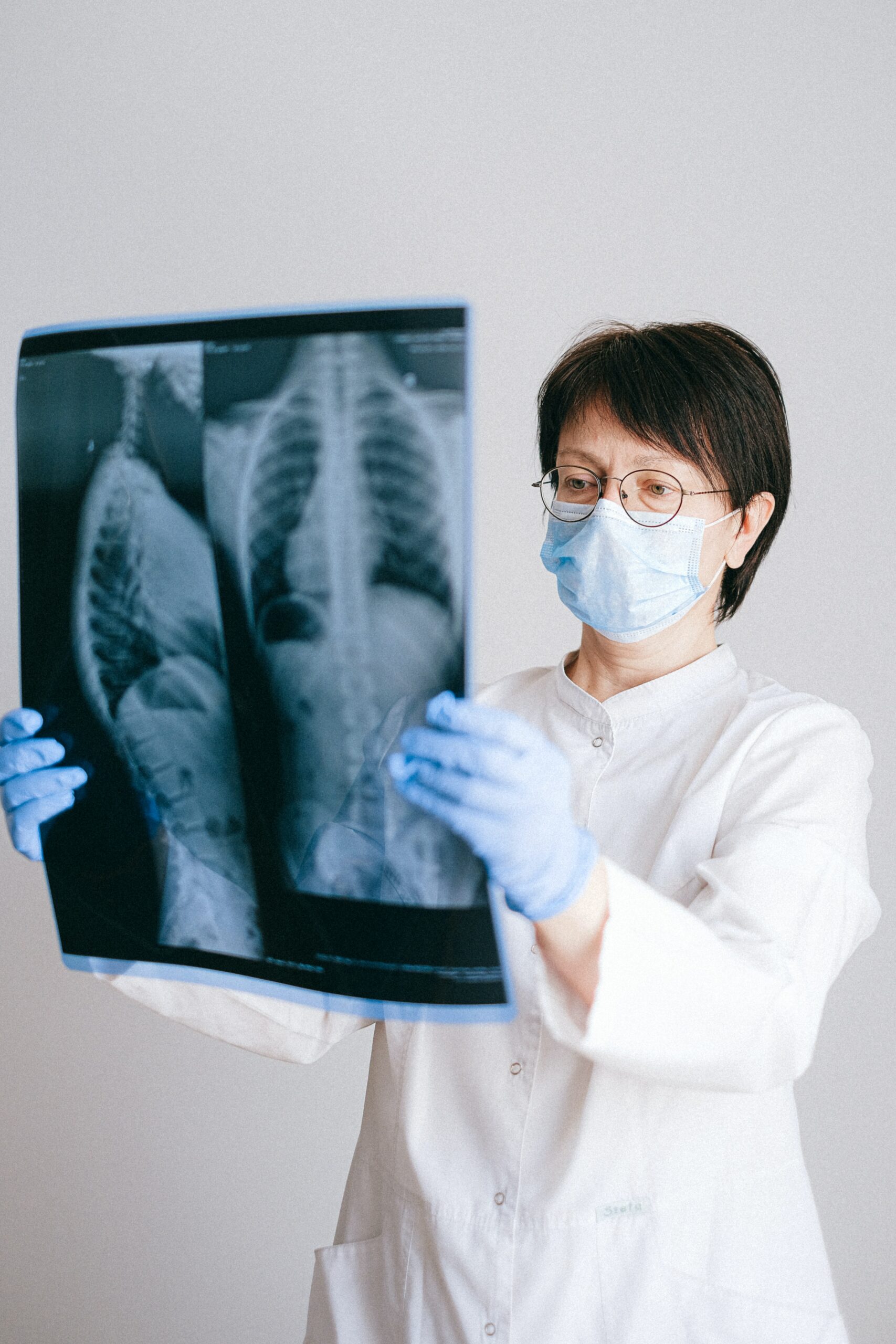 Doctor looking at mesothelioma patient's lung x-rays