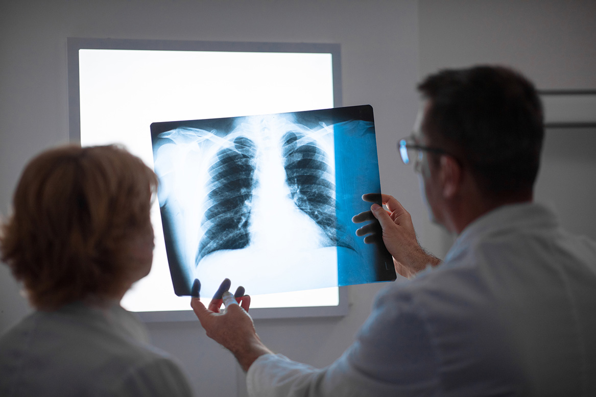 doctor examining an x-ray to confirm a mesothelioma diagnosis