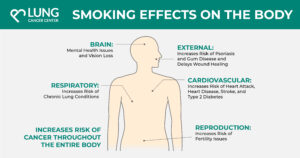 Smoking effects on parts of the body like the brain, respiratory system, cardiovascular system, reproductive system, and externally.