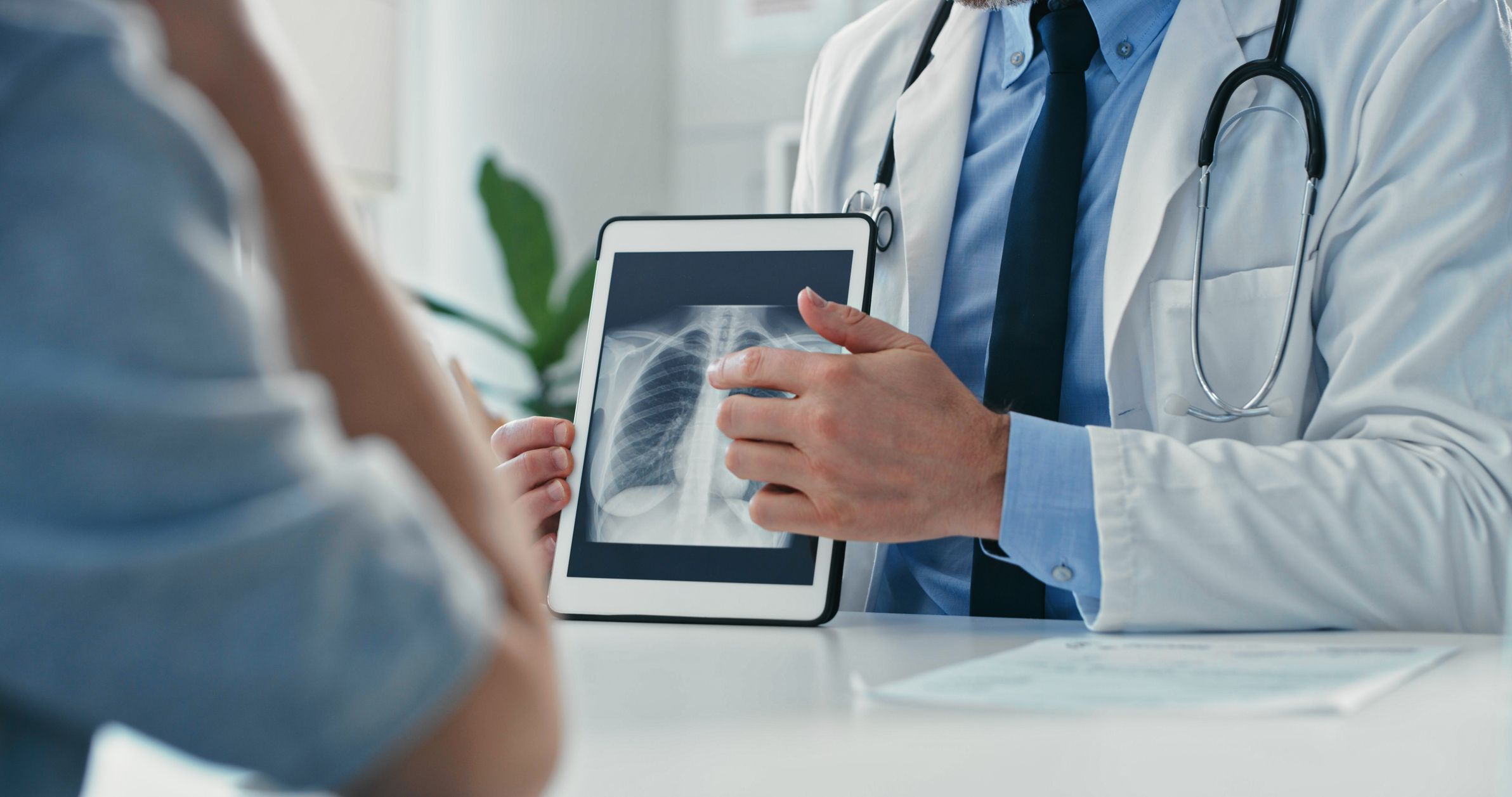 A doctor is discussing a patient's mesothelioma survival rate by examining their chest X-ray.