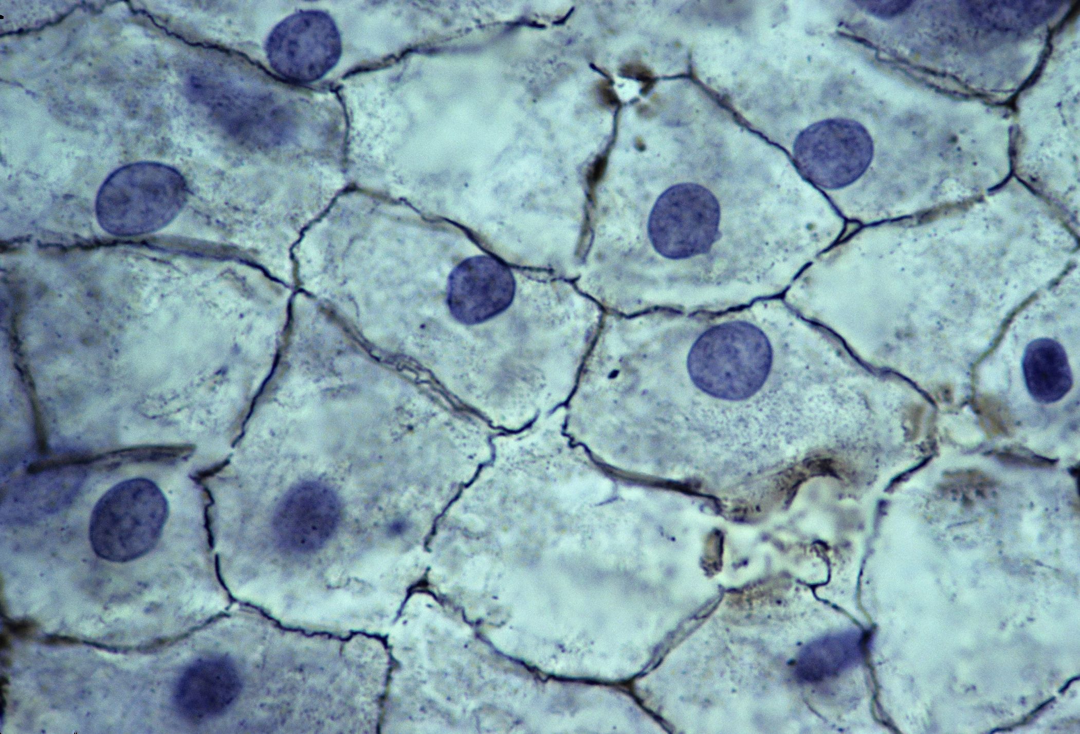 Mesothelial Cells under microscope