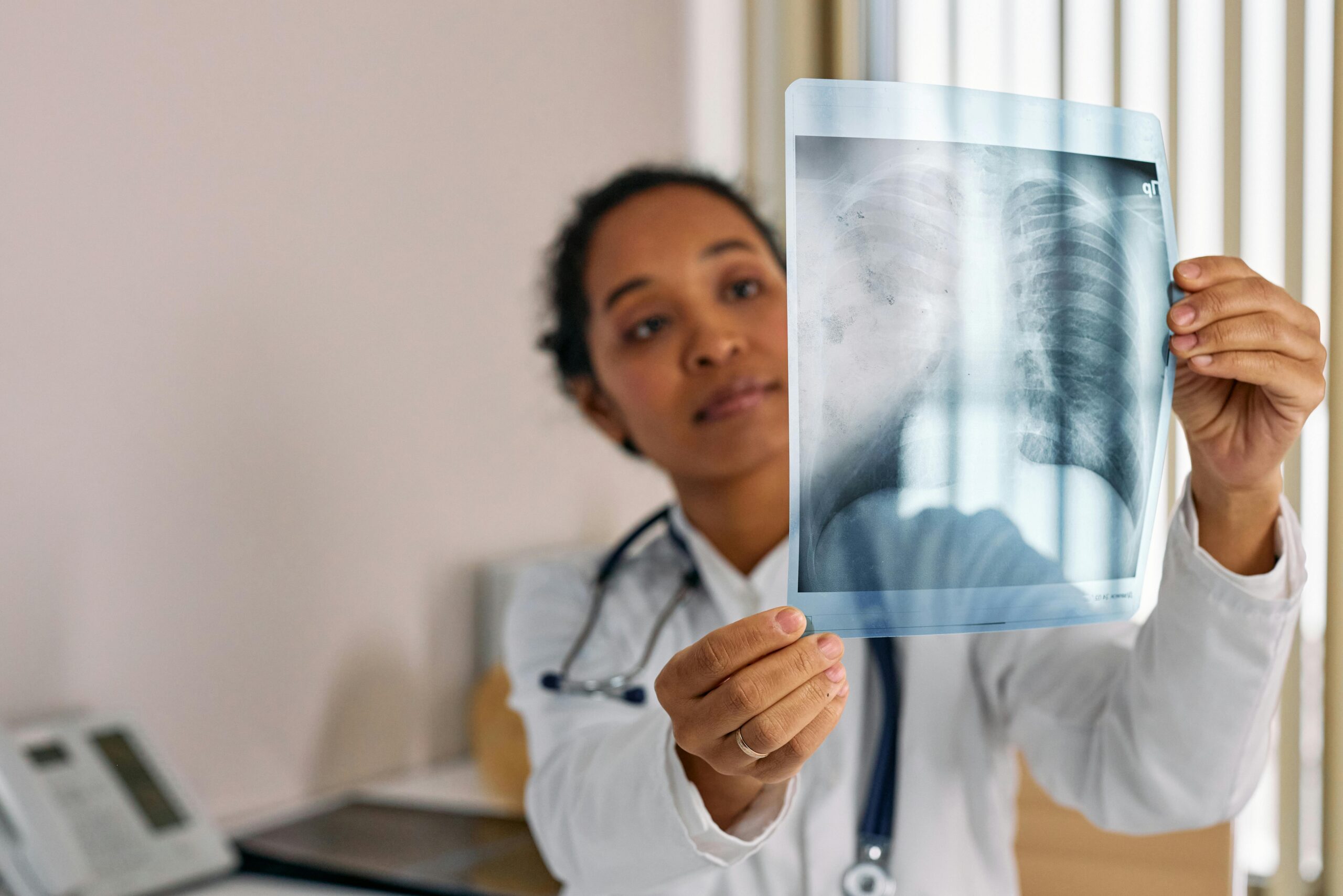 Doctor Looking at an X-ray Image of Lungs for Pleurodesis Treatment